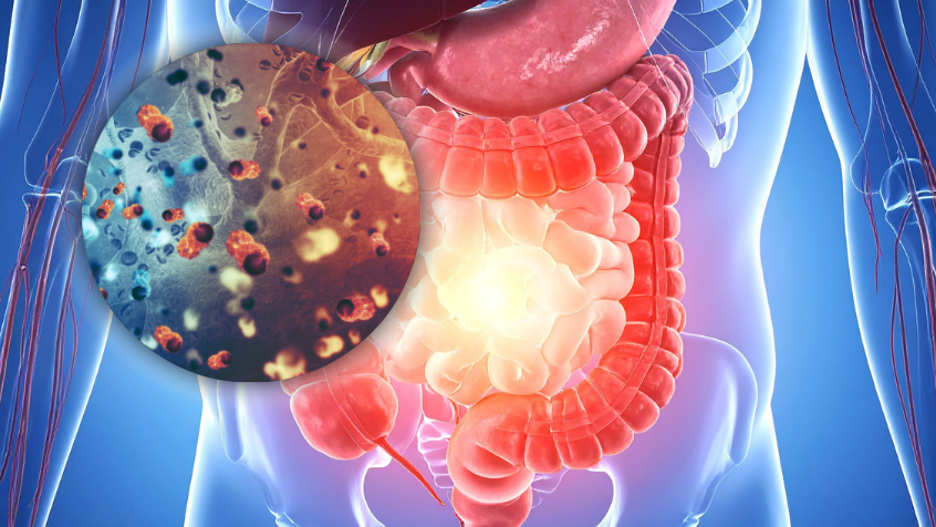 el_cancer_no_aparece_de_repente_lo_que_nadie_te_dice_sobre_prevencion